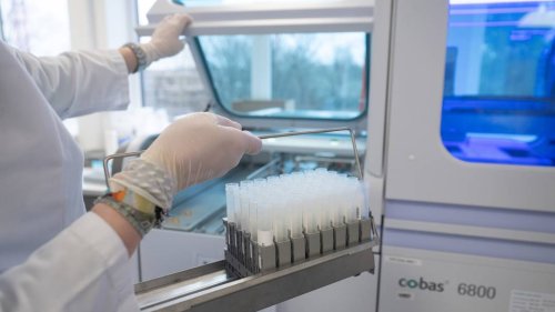 „Wir sind in Deutschland gut aufgestellt“: Laborverband weist Kritik an zu wenigen PCR-Tests zurück