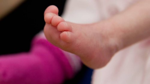 Italien: Ärzte entfernen Zwei-Kilo-Tumor aus Leber von Baby