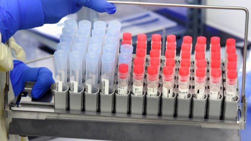 Studien: Britische Variante ist nicht tödlicher - hat aber eine höhere Viruslast