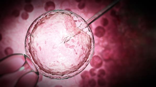 Künstliche Befruchtung: Was sie wissen müssen über die Behandlung