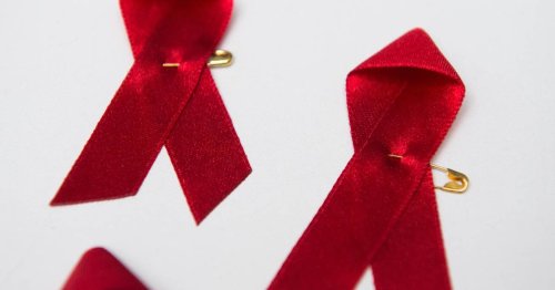 40 Millionen Infizierte weltweit: Wie Aids die Gesellschaft veränderte