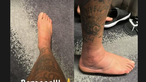 Aua! Neymar teilt Foto von seinem angeschwollenen Knöchel