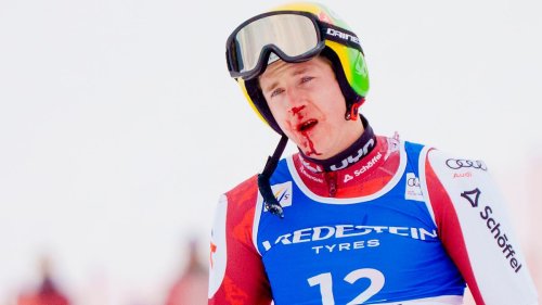 Ski-Star schleppt sich blutverschmiert ins Ziel
