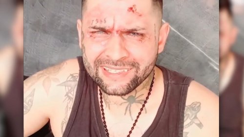 Brasilien: Eifersüchtige Ex kippt Tätowierer Säure ins Gesicht – Motorradhelm rettet ihm das Leben