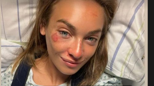 Bahnrad-Weltmeisterin Letizia Paternoster meldet sich nach Horror-Sturz aus der Klinik mit Selfie und Diagnose