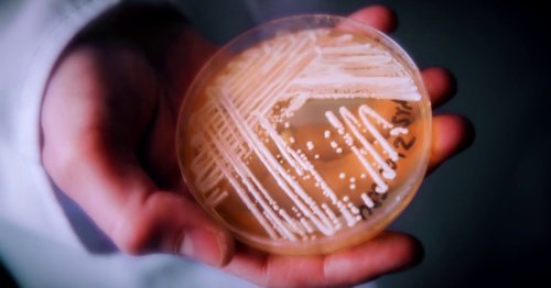 CDC warns dangerous fungus infection poses nationwide threat