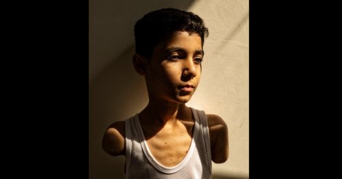 A moment of joy for a boy who lost both arms in an Israeli airstrike
