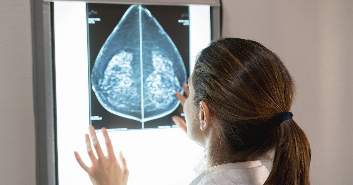 Women must be notified about their breast density in mammogram results, FDA rules
