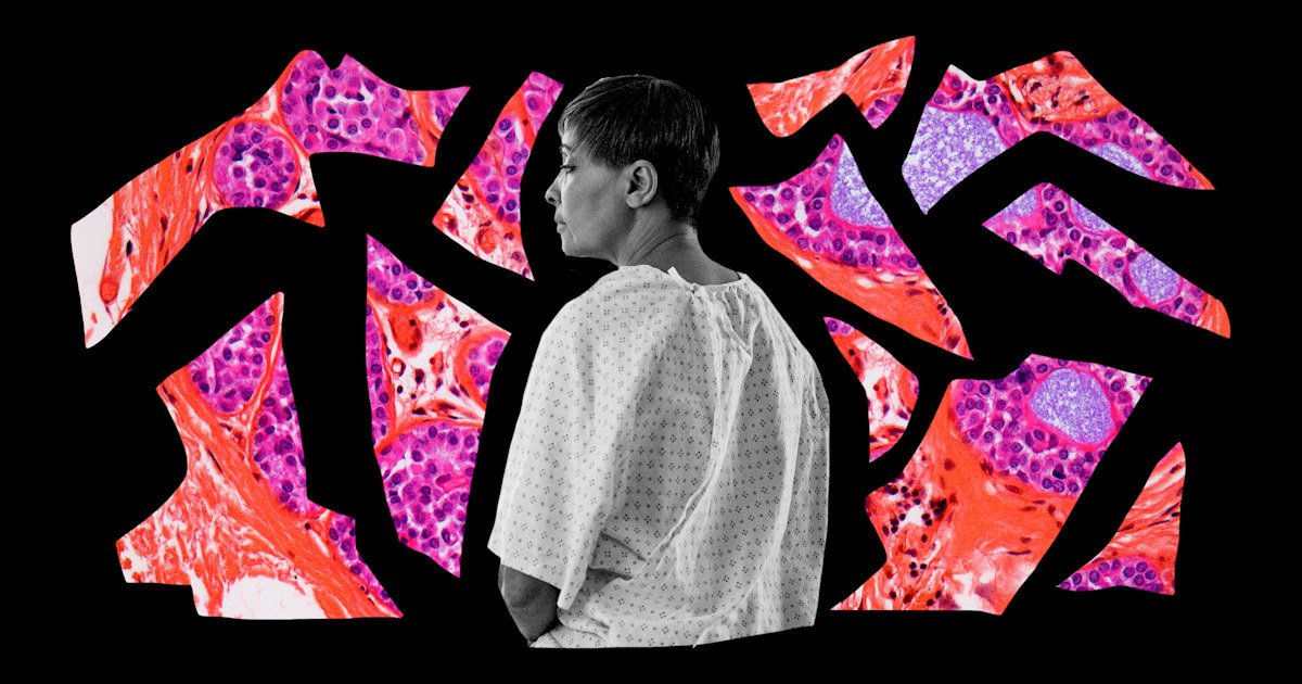 'Black breasts matter': Black women speak out about breast cancer risk