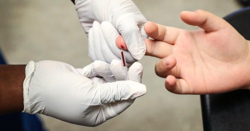 Due to Covid, 2020 was a 'lost year' in the fight against HIV, report suggests