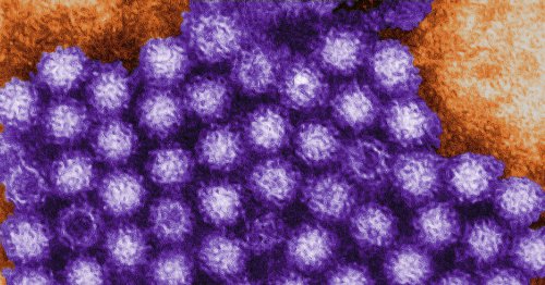 Crohn's disease risk may be linked to norovirus infection, study shows