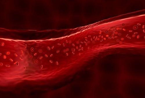 Clots, strokes and rashes: Is COVID a disease of the blood vessels?