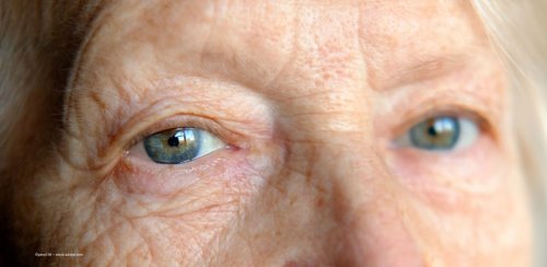 Promising avenues could simplify glaucoma management – just in time