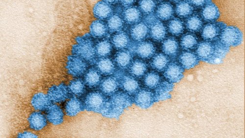 Nearly 100 people infected in ‘very large’ norovirus outbreak in SLO County, officials say