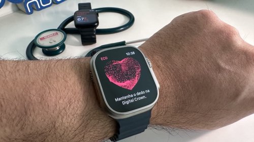 Apple Watch pode ajudar a detetar condição cardíaca potencialmente fatal… diz estudo