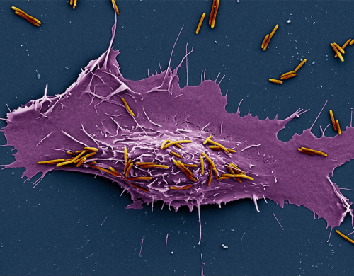 Fusobacterium nucleatum induces proliferation and migration in ...