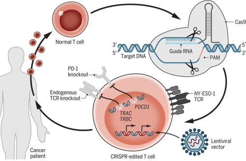 CRISPR-engineered T cells in patients with refractory cancer