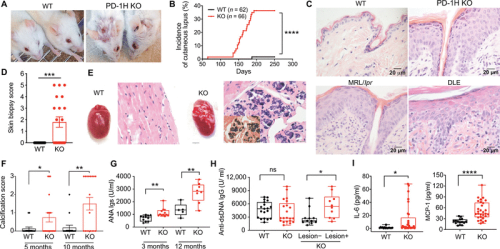 PD-1H (VISTA)–mediated suppression of autoimmunity in systemic and cutaneous lupus erythematosus