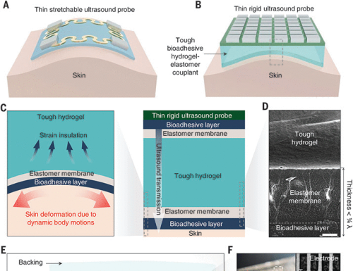 Bioadhesive ultrasound for long-term continuous imaging of diverse organs