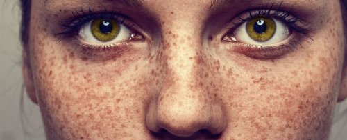 Freckle, Sunspot, or Mole? An Expert Explains How to Tell The Difference.