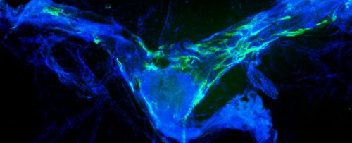 Clearing Brain Waste Dramatically Improves Memory in Aging Mice