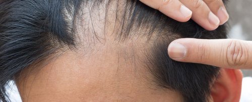 We Now Have The First Evidence That Immune Cells in The Skin Directly Trigger Hair Growth