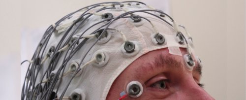 Biggest Study Yet Suggests Electric Stimulation Boosts Brain Function