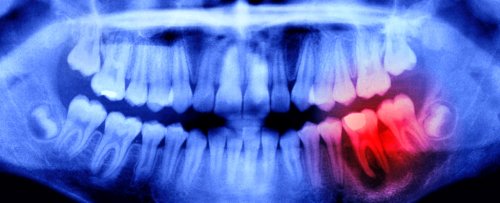 Expert Reveals a Surprising Link Between Oral Health And Your Brain