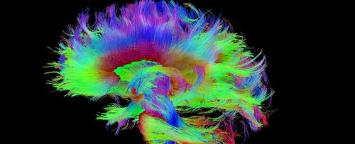 Harvard Scientists Think They've Pinpointed The Physical Source of Consciousness