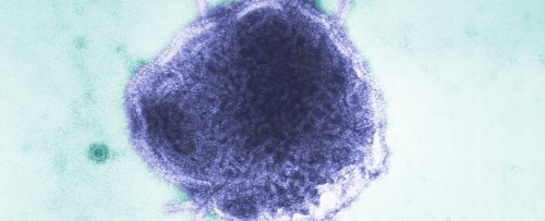 Measles Could Become Endemic in US if Surge Continues, Expert Warns