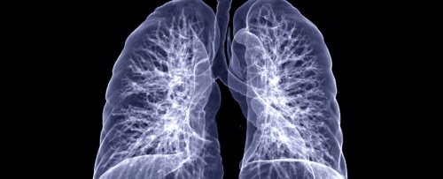 Still Short of Breath? Here Are 3 Ways COVID-19 Can Damage Lungs Long Term