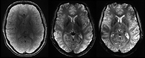First Images of Human Brain From World's Most Powerful MRI Revealed