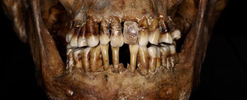 A 17th-Century Aristocrat Had a Crafty Secret For Keeping Her Teeth