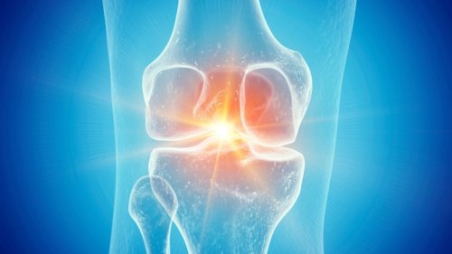 Semaglutide May Reverse Damage Caused by Osteoarthritis, Study Suggests