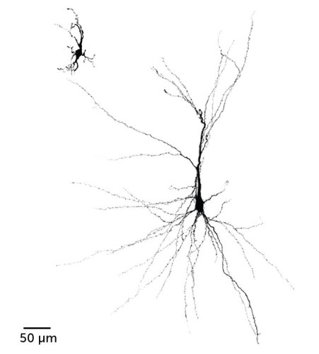 Clumps Of Human Nerve Cells Thrived In Rat Brains Flipboard