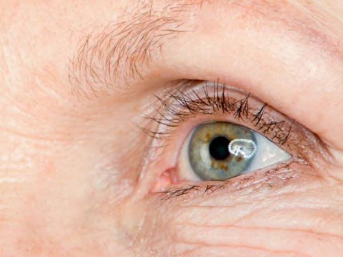 Maladies des yeux : des vitamines protectrices