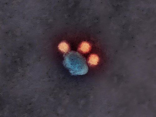 Le virus Zika utile une technique sournoise pour atteindre le placenta