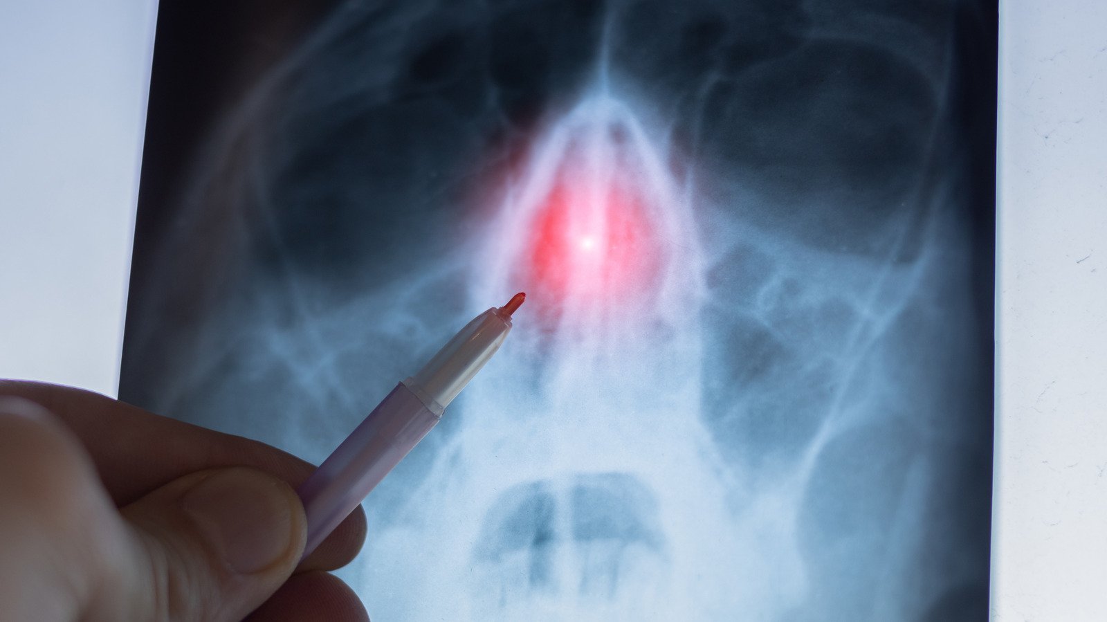 This Useless Organ Turned Out To Be Super Important - cover