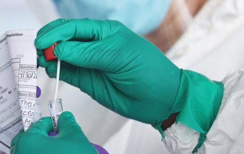 Why the United States Is Having a Coronavirus Data Crisis