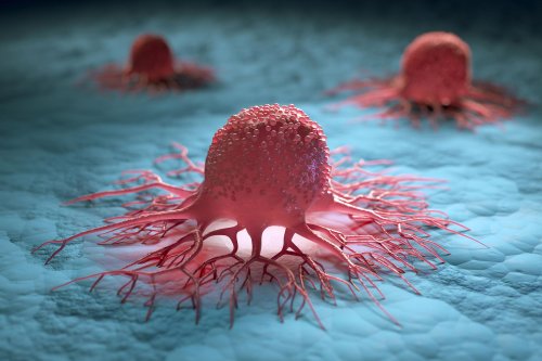“Shocking” Findings – Scientists Discover How Stress Triggers Cancer’s Spread