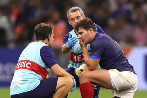 Antoine Dupont injury: France captain to have scans to discover extent of facial blow as fears grow over Rugby World Cup participation