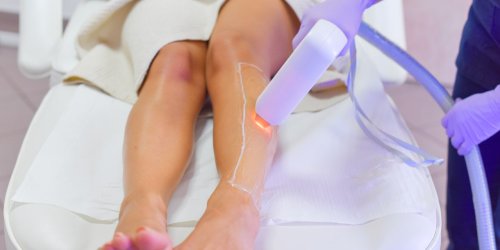 Read This Before You Get Laser Hair Removal