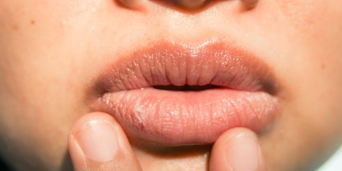 Here’s Exactly How to Deal With Flaky, Chapped Lips