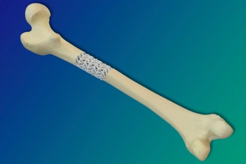 ‘진짜 뼈’로 바뀌는 3D 프린팅 출력 인공 뼈 [와우! 과학]
