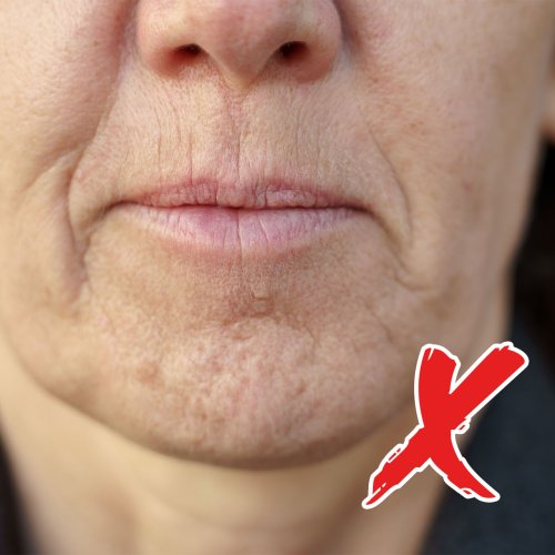 5 Common Mistakes That Can 'Destroy And Degrade' Collagen Levels And 'Rapidly' Age The Face: UV Light, More