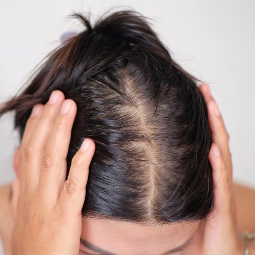 Derms Agree: This Is The Best Vitamin To Take Every Day For Thinning Hair