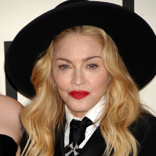 Madonna Looks Unrecognizable Now—a Plastic Surgeon Weighs In Flipboard 6294