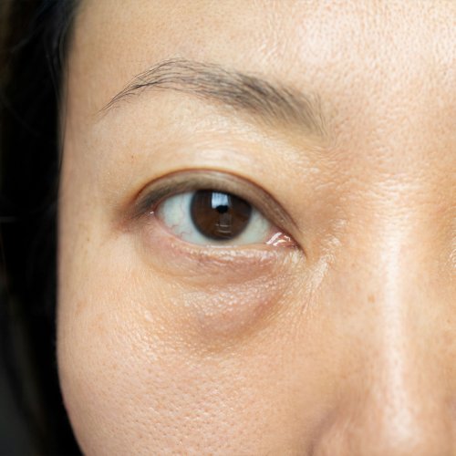 An Expert Reveals How To Minimize The Appearance Of Under Eye Bags, Fine Lines & Puffiness