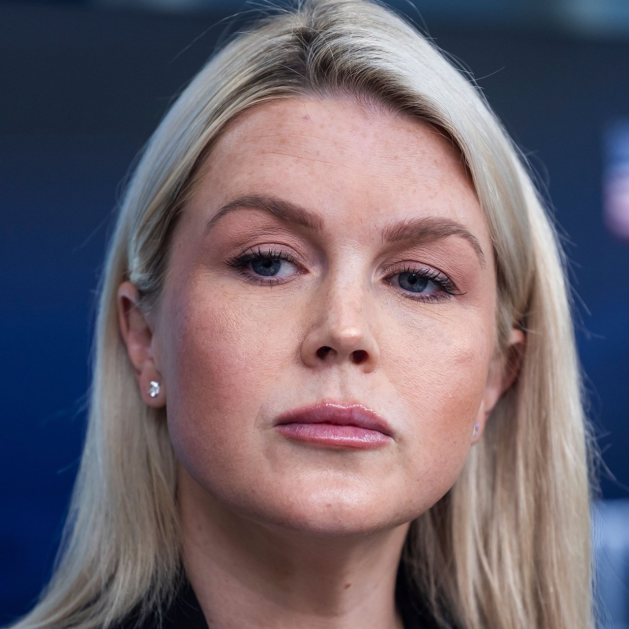 Social Media Says Karoline Leavitt Has 'Gone Too Far' With Cosmetic Enhancements After Seeing Her Transformation Over Th