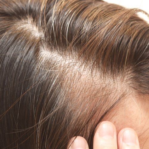 The Best Hair Supplements That Actually Help With Thinning Hair For Women Over 40